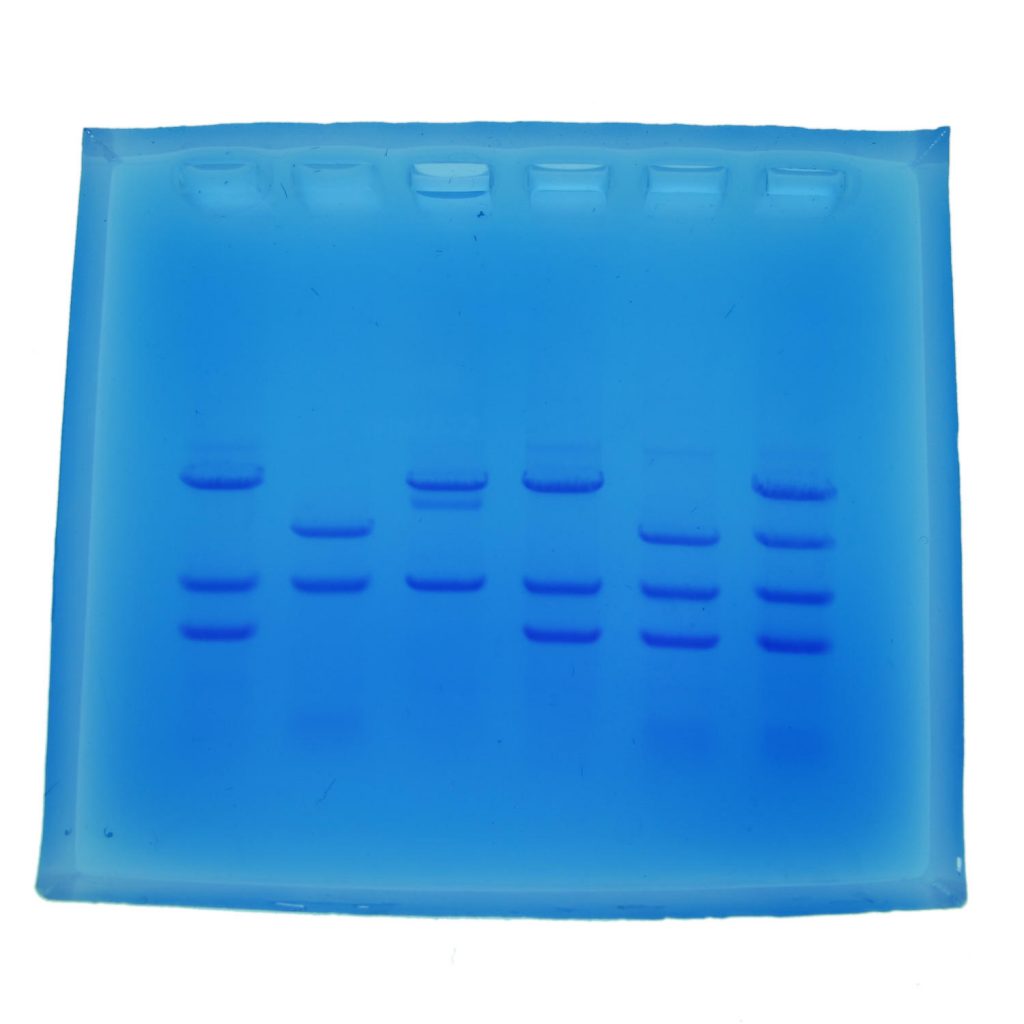 Cystic Fibrosis – Electrophoresis Education Kit - Labmal