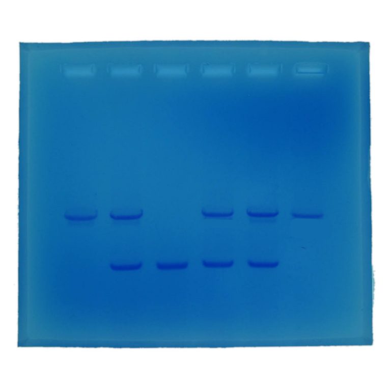 Cystic Fibrosis – Electrophoresis Education kit - LabMal